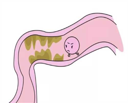 石家庄靠谱供卵机构,患有子宫腺肌症